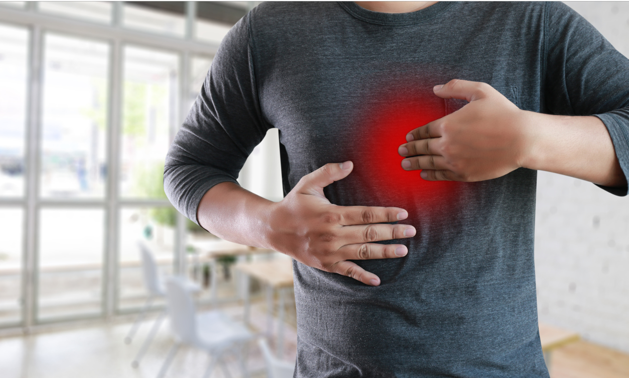 acid reflux symptoms