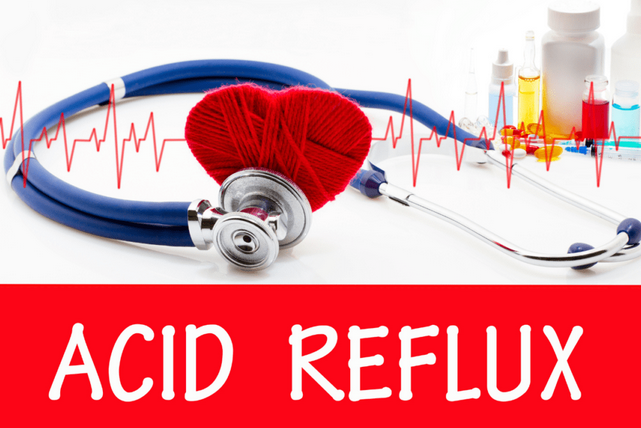 managing acid reflux