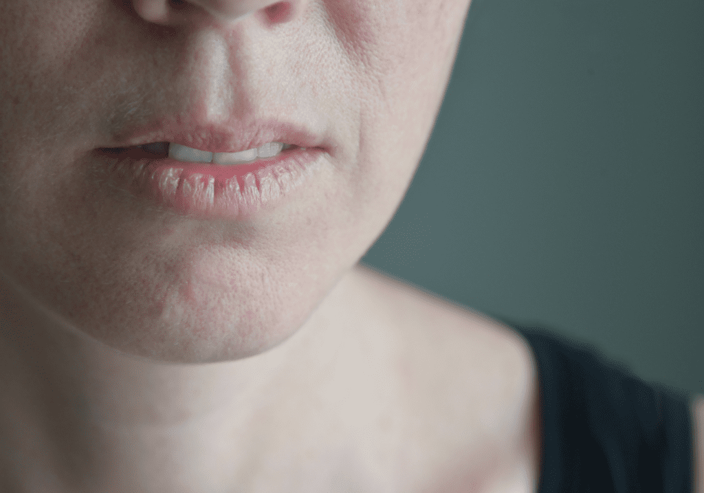 causes of mouth malodor