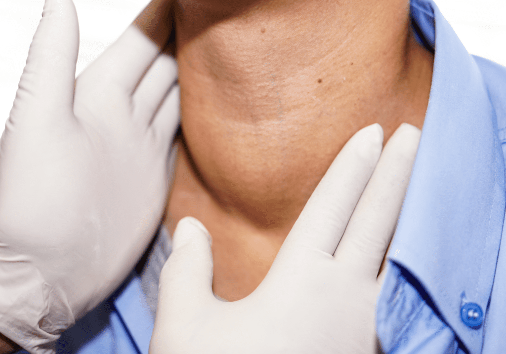 Overactive Thyroid Solutions