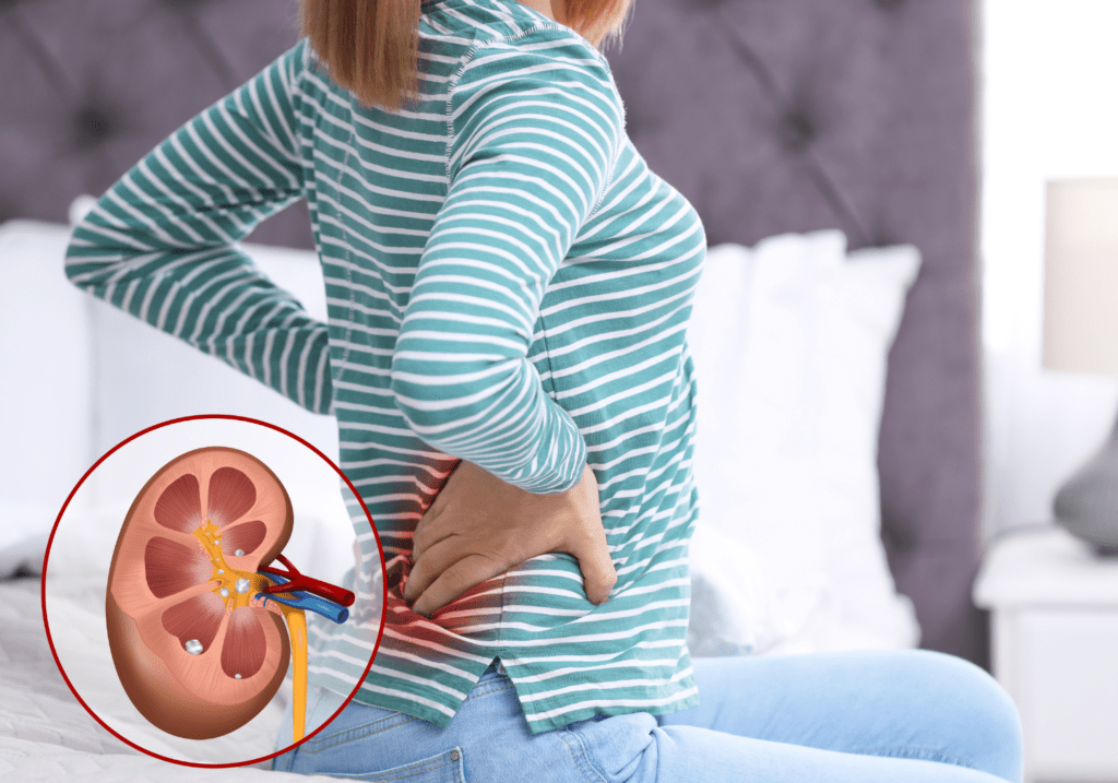 can kidney stones affect your life