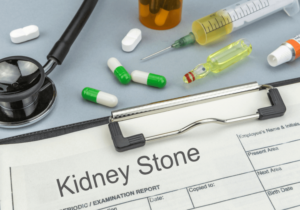 do you have kidney stones