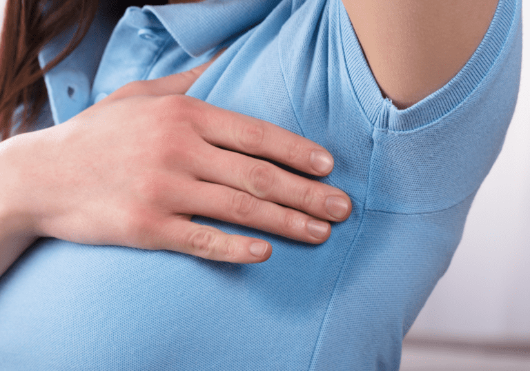 excessive sweating remedies