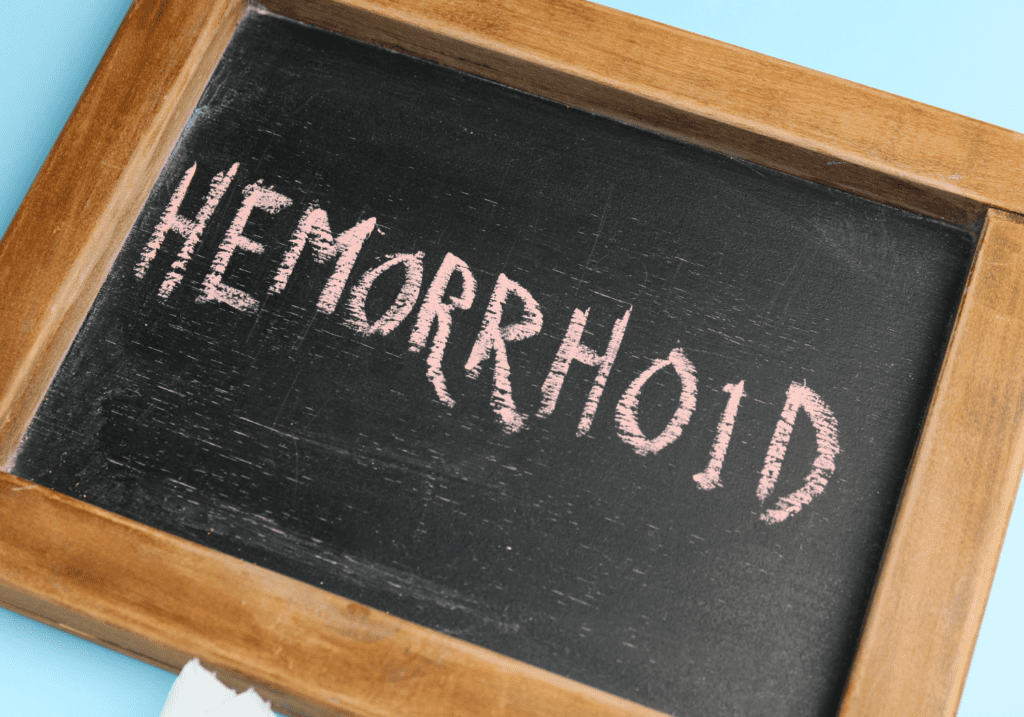 hemorrhoid remedies