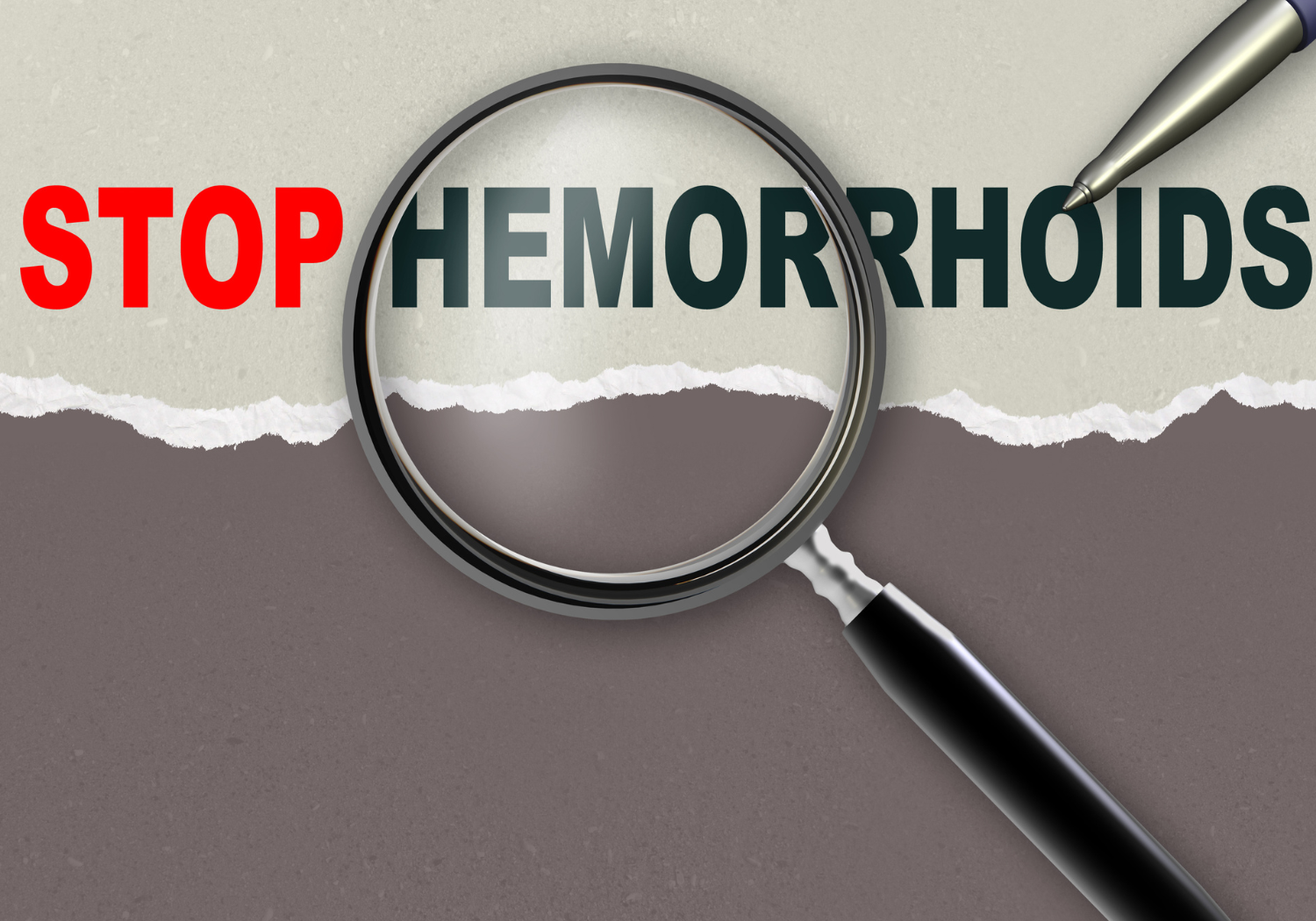 hemorrhoid treatments