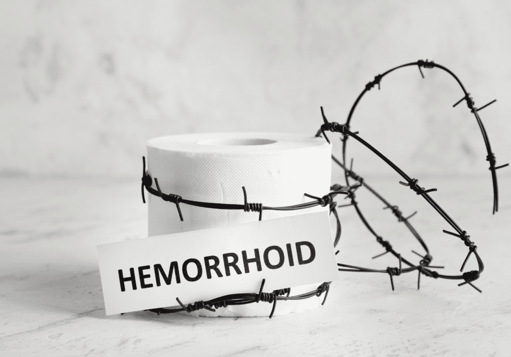 hemorrhoids 101