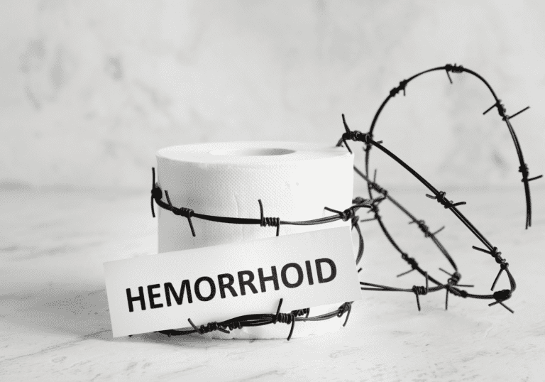 hemorrhoids 101
