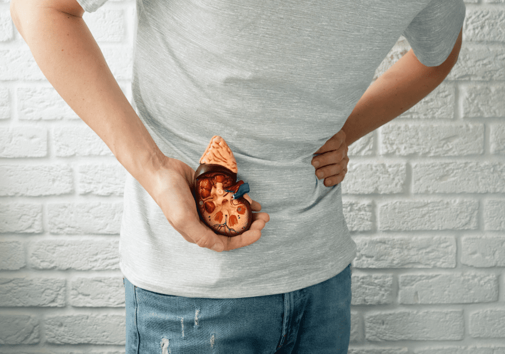 impact of kidney stones