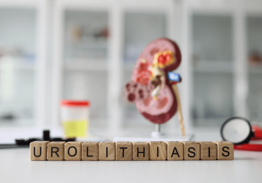 kidney stone screening methods