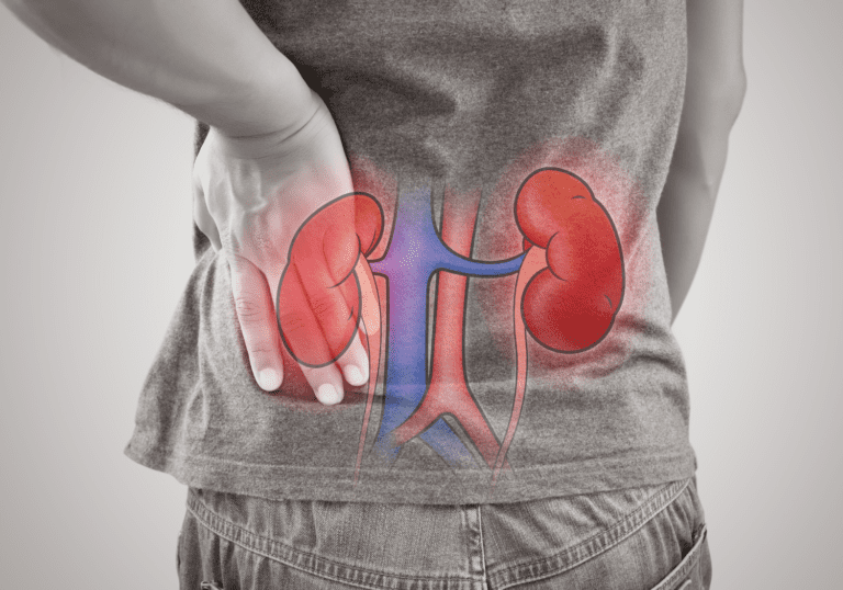 natural ways of fighting kidney stones
