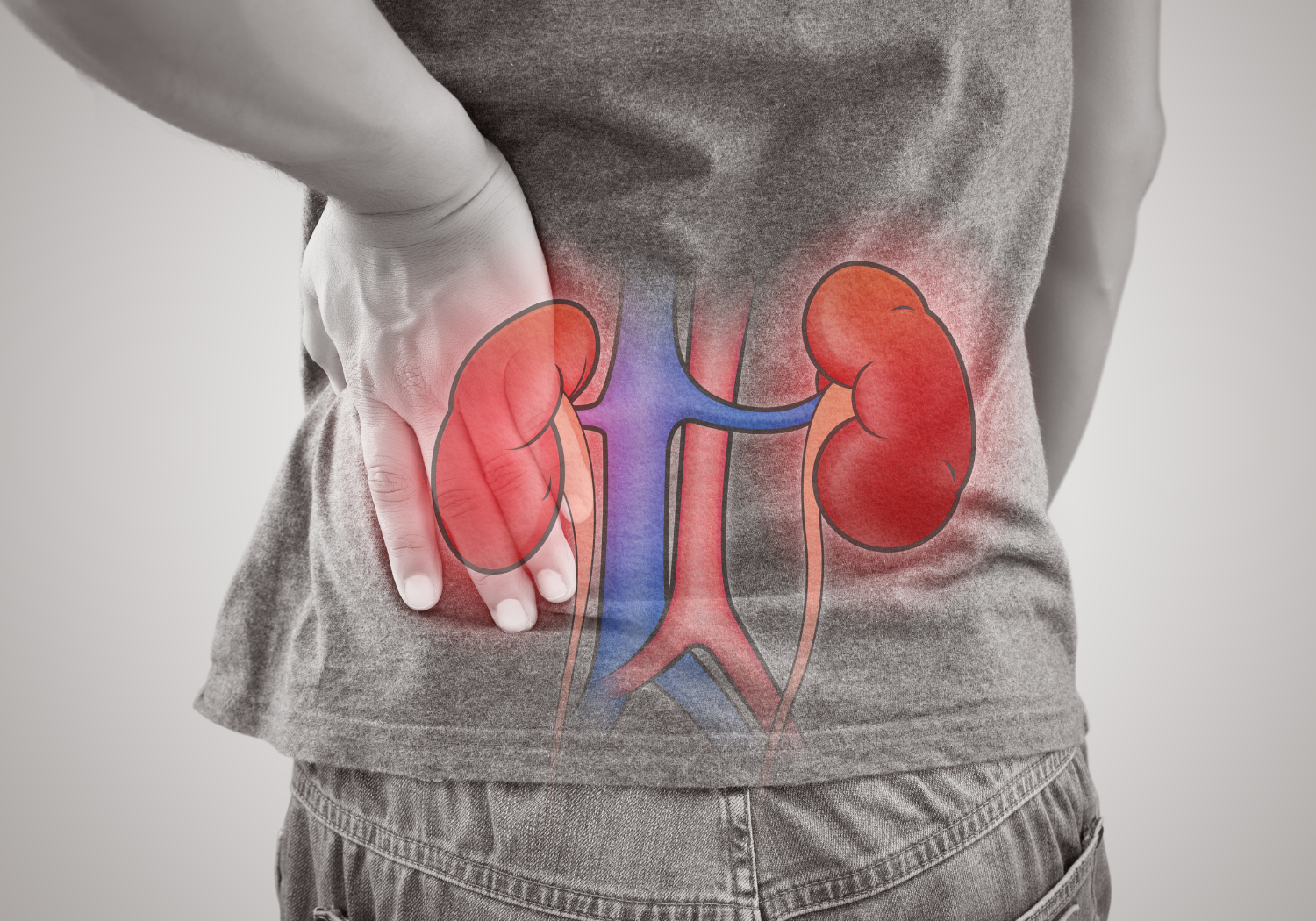 natural ways of fighting kidney stones