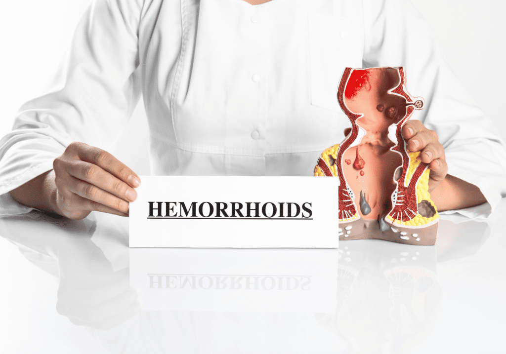 questions about hemorrhoids