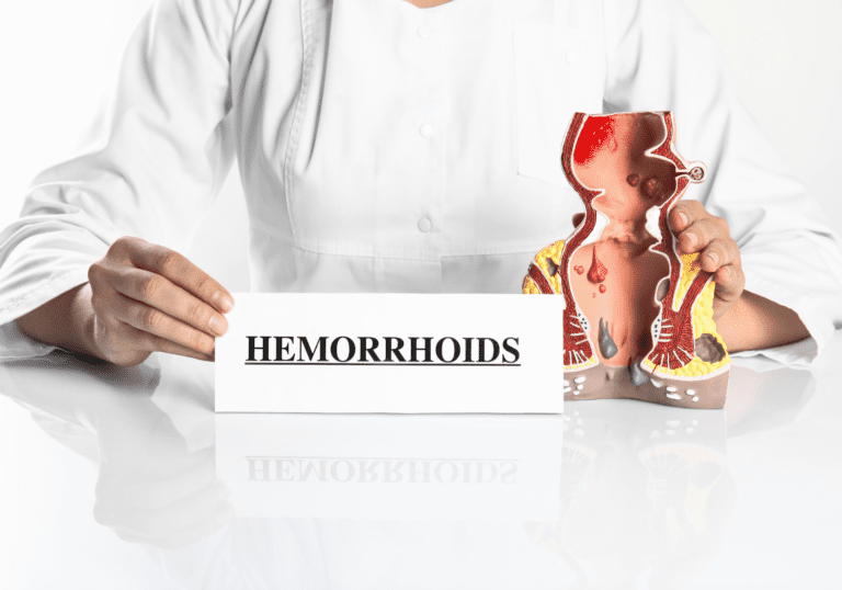 questions about hemorrhoids