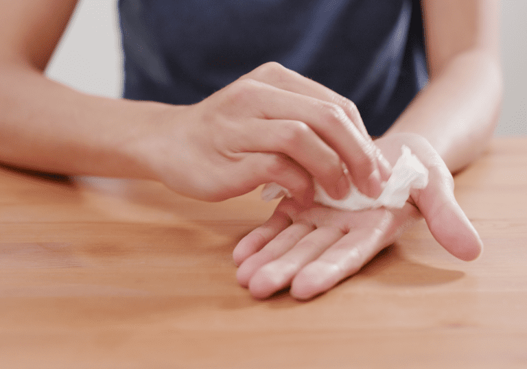 tips for excessive sweating