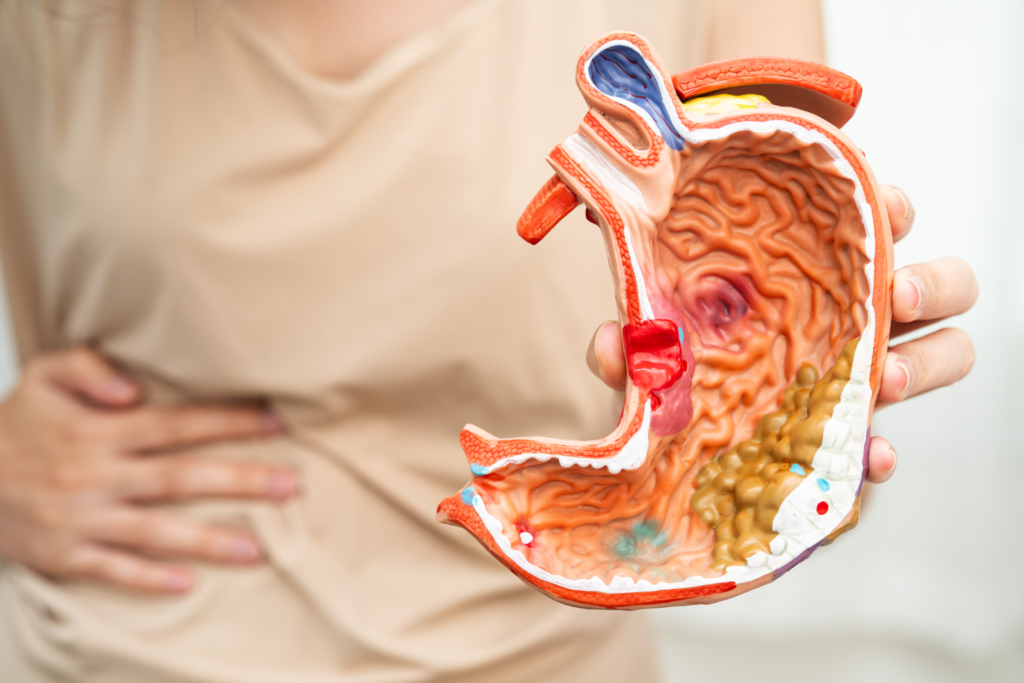 Bloating After Eating Bread